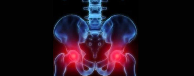 Hip Conditions and Physical Therapy
