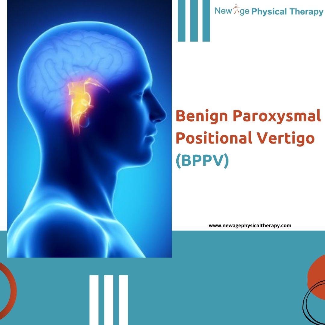 Vertigo BPPV